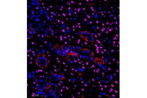 Immunofluorescence of paraffin embedded rat kidney using pax2 (ABIN7074974) at dilution of 1:600 (350x lens) (PAX2A antibody)