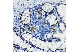 Immunohistochemistry of paraffin-embedded mouse colon using S Rabbit mAb (ABIN7270152) at dilution of 1:100 (40x lens). (SATB2 antibody)