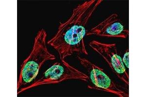 Fluorescent confocal image of HeLa cell stained with TERT antibody at 1:25. (TERT antibody  (AA 627-656))