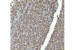 IHC analysis of hnRNP L/HNRNPL using anti-hnRNP L/HNRNPL antibody (ABIN7600130). (HNRNPL antibody  (AA 152-569))