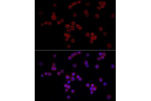 Immunofluorescence analysis of K-562 cells using NF Rabbit pAb (ABIN6130595, ABIN6144558, ABIN6144559 and ABIN6222368) at dilution of 1:50 (40x lens). (NFATC3 antibody  (AA 1-290))