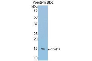 Western Blotting (WB) image for anti-RalA Binding Protein 1 (RALBP1) (AA 527-626) antibody (ABIN1176613) (RALBP1 antibody  (AA 527-626))