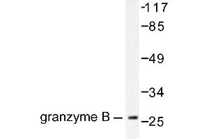 Image no. 1 for anti-Granzyme B (GZMB) antibody (ABIN265445) (GZMB antibody)