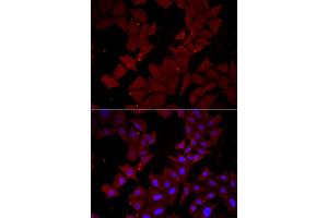 Immunofluorescence analysis of HeLa cells using CCT4 antibody (ABIN5973931). (CCT4 antibody)