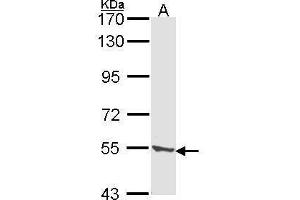 WB Image Sample (30 ug of whole cell lysate) A: A431 , 7. (TPP1 antibody)