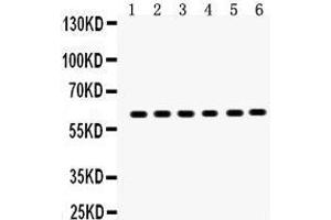 Anti-EAAT2 antibody, Western blotting All lanes: Anti EAAT2  at 0. (SLC1A2 antibody  (AA 461-574))
