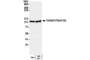 Western Blotting (WB) image for anti-Thyroid Hormone Receptor Associated Protein 3 (THRAP3) (AA 375-425) antibody (ABIN7452455) (THRAP3 antibody  (AA 375-425))