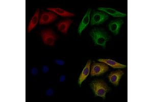ABIN7094746 and ABIN7098797 staining Hela cells by IF/ICC. (VPS29 antibody  (N-Term))