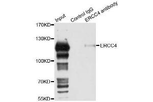 Immunoprecipitation analysis of 150ug extracts of 293T cells using 3ug ERCC4 antibody. (ERCC4 antibody  (AA 600-700))