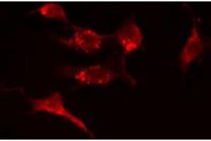 ABIN6274389 staining A549 cells by IF/ICC. (CERKL antibody  (Internal Region))