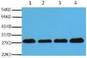 Western Blotting (WB) image for anti-Proliferating Cell Nuclear Antigen (PCNA) antibody (ABIN3178584) (PCNA antibody)