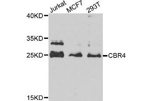Western blot analysis of extracts of various cell lines, using CBR4 antibody (ABIN5972931) at 1/1000 dilution. (CBR4 antibody)