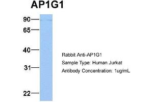Host: Rabbit Target Name: AP1G1 Sample Type: Jurkat Antibody Dilution: 1. (gamma 1 Adaptin antibody  (C-Term))