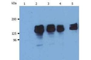 Western Blotting (WB) image for anti-Inositol Polyphosphate-5-Phosphatase, 145kDa (INPP5D) (N-Term) antibody (ABIN238500) (INPP5D antibody  (N-Term))