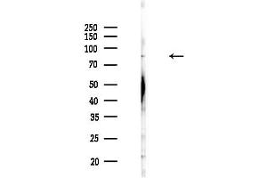 anti-Acyl-CoA Synthetase Long-Chain Family Member 6 (ACSL6) (Internal Region) antibody