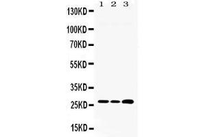 Western blot analysis of RPL19 expression in rat liver extract ( Lane 1) HEPA whole cell lysates ( Lane 2) and HEPG2 whole cell lysates ( Lane 3).
