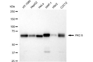 Western blotting analysis using PKC delta antibody (ABIN7799995).