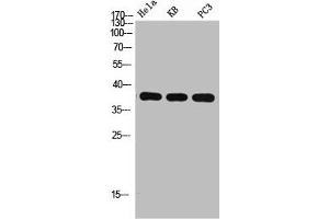 Western Blot analysis of HELA KB PC-3 using p38 Polyclonal Antibody. (MAPK14 antibody  (C-Term))
