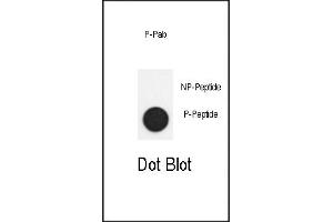 Dot blot analysis of anti-Phospho-SD2- Antibody (ABIN390037 and ABIN2839786) on nitrocellulose membrane. (SMAD2 antibody  (pSer118))