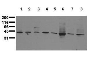 Western Blotting (WB) image for anti-Mitogen-Activated Protein Kinase Kinase 3 (MAP2K3) antibody (ABIN126840) (MAP2K3 antibody)