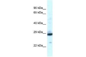 Western Blot showing PGAM1 antibody used at a concentration of 1 ug/ml against Fetal Liver Lysate