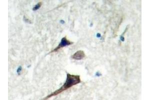 Image no. 1 for anti-14-3-3 epsilon (YWHAE) antibody (ABIN272265) (YWHAE antibody)