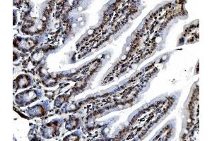 IHC analysis of REA/PHB2 using anti-REA/PHB2 antibody (ABIN7599239).