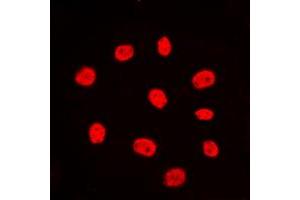 Immunofluorescent analysis of Estrogen Receptor alpha staining in MCF7 cells.