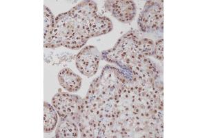 Immunohistochemical analysis of A on paraffin-embedded Human placenta tissue. (TARDBP antibody  (N-Term))
