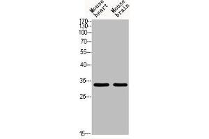 Western blot analysis of MOUSE-HEART MOUSE-BRAIN using Acetyl-TAL1/2 (K221/K222/K36/K37) antibody. (TAL1 antibody  (acLys36, acLys37, acLys221, acLys222))