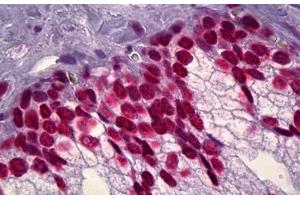 Anti-DNA ds antibody IHC staining of human prostate. (dsDNA antibody)