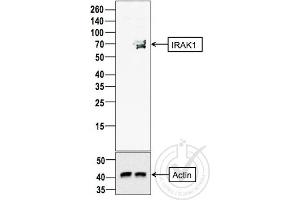 Image provided by the Independent Validation Program (badge number 29809). (IRAK1 antibody  (AA 301-400))