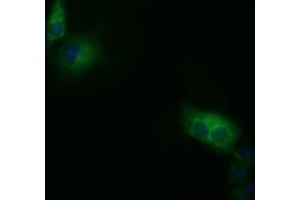 Anti-SDR9C7 mouse monoclonal antibody (ABIN2453629) immunofluorescent staining of COS7 cells transiently transfected by pCMV6-ENTRY SDR9C7 (RC210941). (SDR9C7 antibody)
