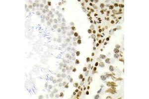 Immunohistochemistry of paraffin-embedded rat testis using NFKB2 antibody at dilution of 1:200 (400x lens). (NFKB2 antibody)