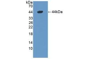 Detection of Recombinant DEFa1, Mouse using Polyclonal Antibody to Defensin Alpha 1, Neutrophil (DEFa1) (alpha Defensin 1 antibody  (AA 20-93))