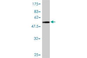 Western Blot detection against Immunogen (46. (TNNI1 antibody  (AA 1-187))