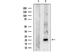 anti-Coiled-Coil-Helix-Coiled-Coil-Helix Domain Containing 3 (CHCHD3) (N-Term) antibody