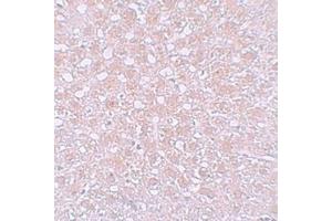 Immunohistochemistry analysis of AFP in rat liver tissue with Alpha-fetoprotein (AFP)  Antibody (N-term) at 10 μg/ml.