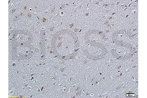 Formalin-fixed and paraffin embedded rat brain labeled with Anti P45017A1/Cytochrome P450 17A1 Polyclonal Antibody, Unconjugated (ABIN720445) at 1:200 followed by conjugation to the secondary antibody and DAB staining (GANAB antibody  (AA 428-540))