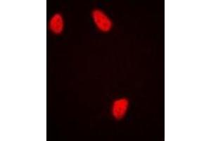 Immunofluorescent analysis of NUDC staining in HepG2 cells. (NUDC antibody)