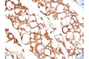 Mouse visceral white fat tissue was stained by Rabbit Anti-Vaspin (386-414) (Human) Serum (SERPINA12 antibody  (AA 386-414))