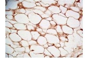 Rat visceral fat tissue was stained by Rabbit Anti-Cathepsin S (298-331) (Human) Serum (Cathepsin S antibody  (AA 298-331))