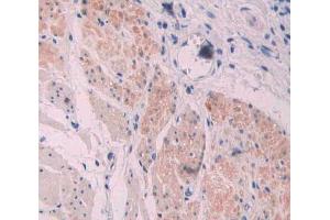 Used in DAB staining on fromalin fixed paraffin- embedded stomach cancer tissue (Supervillin antibody  (AA 1385-1525))