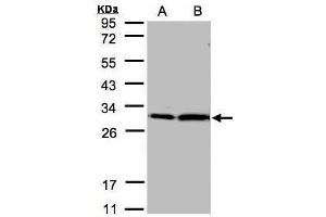 WB Image Sample(30 μg of whole cell lysate) A:Hep G2, B:MOLT4, 12% SDS PAGE antibody diluted at 1:2000 (14-3-3 zeta antibody  (Center))
