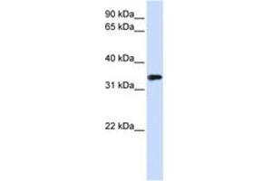 Image no. 1 for anti-Methyl-CpG Binding Domain Protein 3 (MBD3) (AA 72-121) antibody (ABIN6740655) (MBD3 antibody  (AA 72-121))