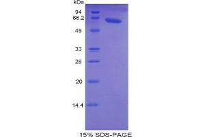SDS-PAGE analysis of Human TNNC2 Protein. (TNNC2 Protein)