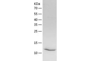 Western Blotting (WB) image for Succinate Dehydrogenase Complex Assembly Factor 2 (Sdhaf2) (AA 30-166) protein (His tag) (ABIN7289101) (Sdhaf2 Protein (AA 30-166) (His tag))