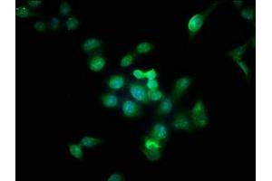 Immunofluorescence staining of Hela cells with ABIN7145079 at 1:166, counter-stained with DAPI. (Aurora Kinase B antibody  (AA 1-255))