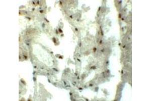 Immunohistochemical staining of human lung cells with GCOM1 polyclonal antibody  at 5 ug/mL. (GCOM1 antibody  (C-Term))