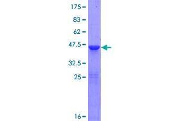 RNF181 Protein (AA 1-153) (GST tag)